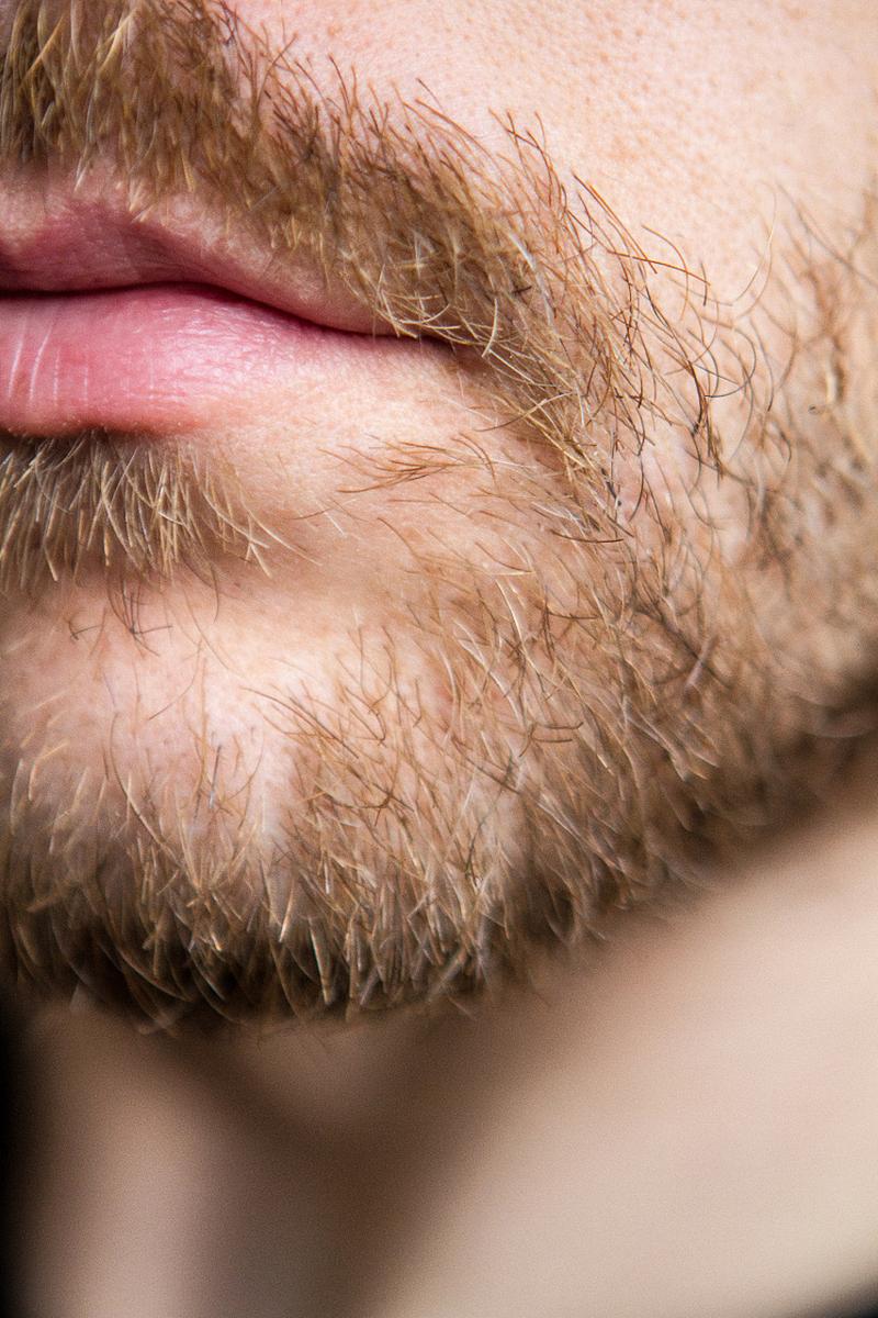 脸上为什么有毛