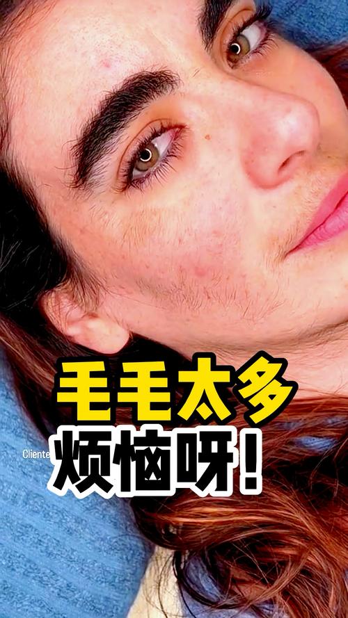 脸上为什么有毛