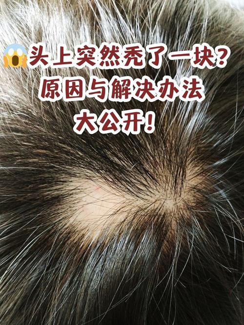 头发老是掉什么原因