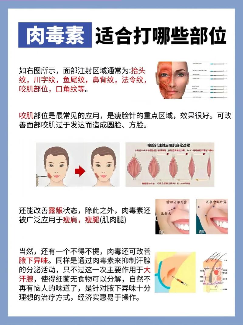 瘦脸针有什么作用