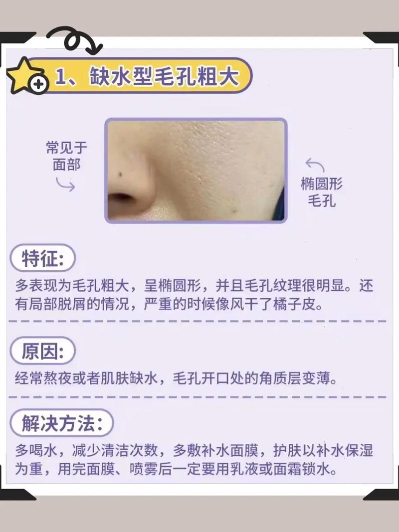 为什么皮肤毛孔粗大