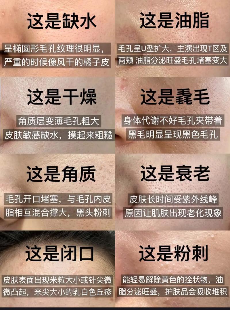 为什么皮肤毛孔粗大