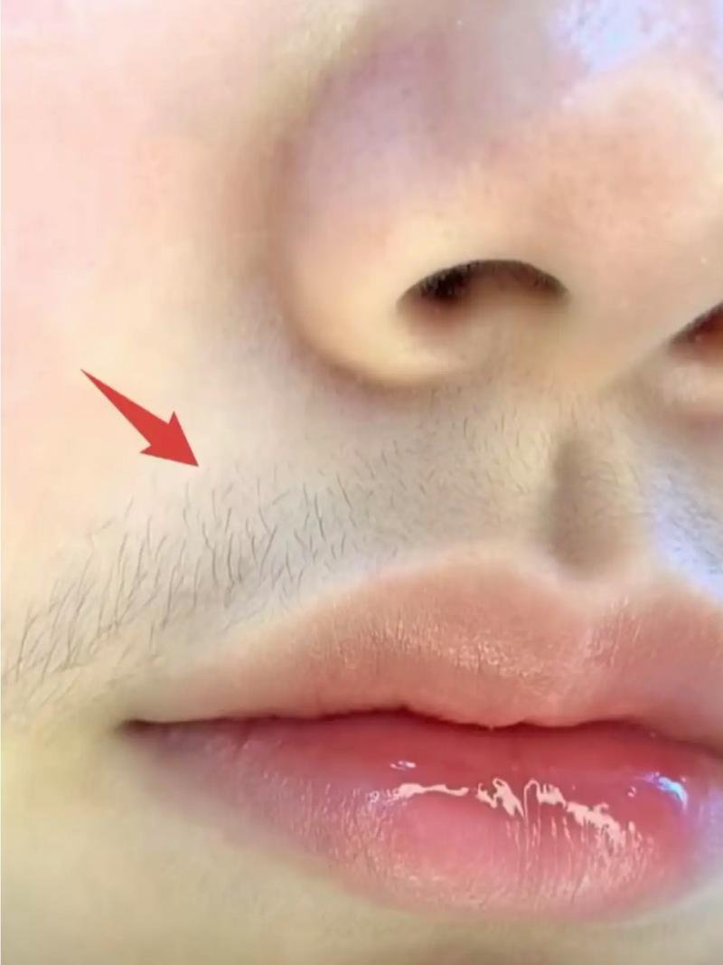 为什么有唇毛