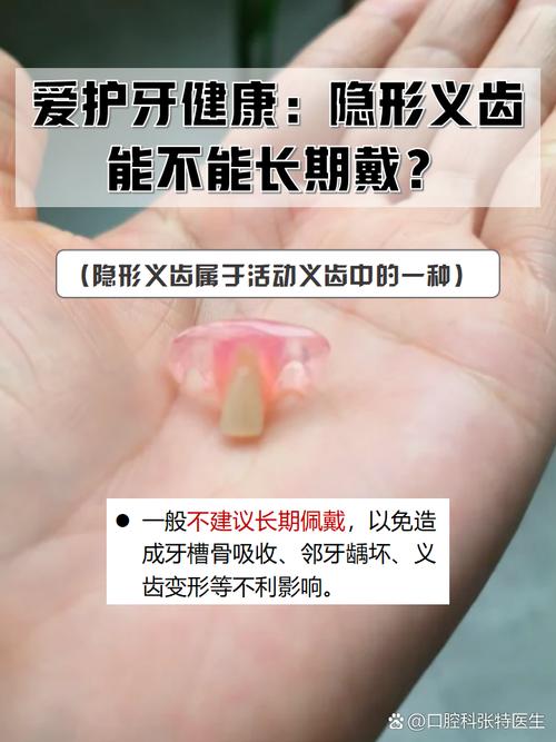 隐形义齿是什么