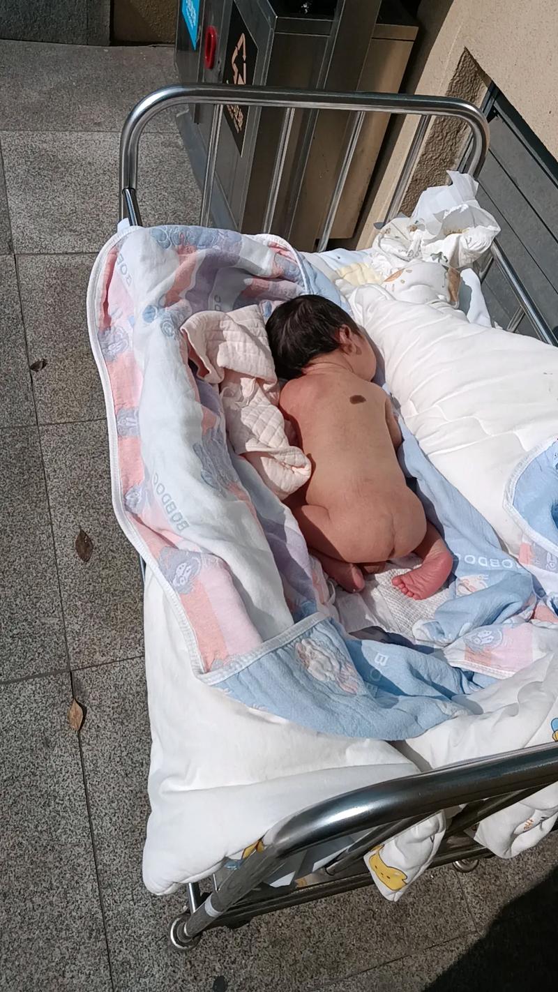 背上有胎记代表什么