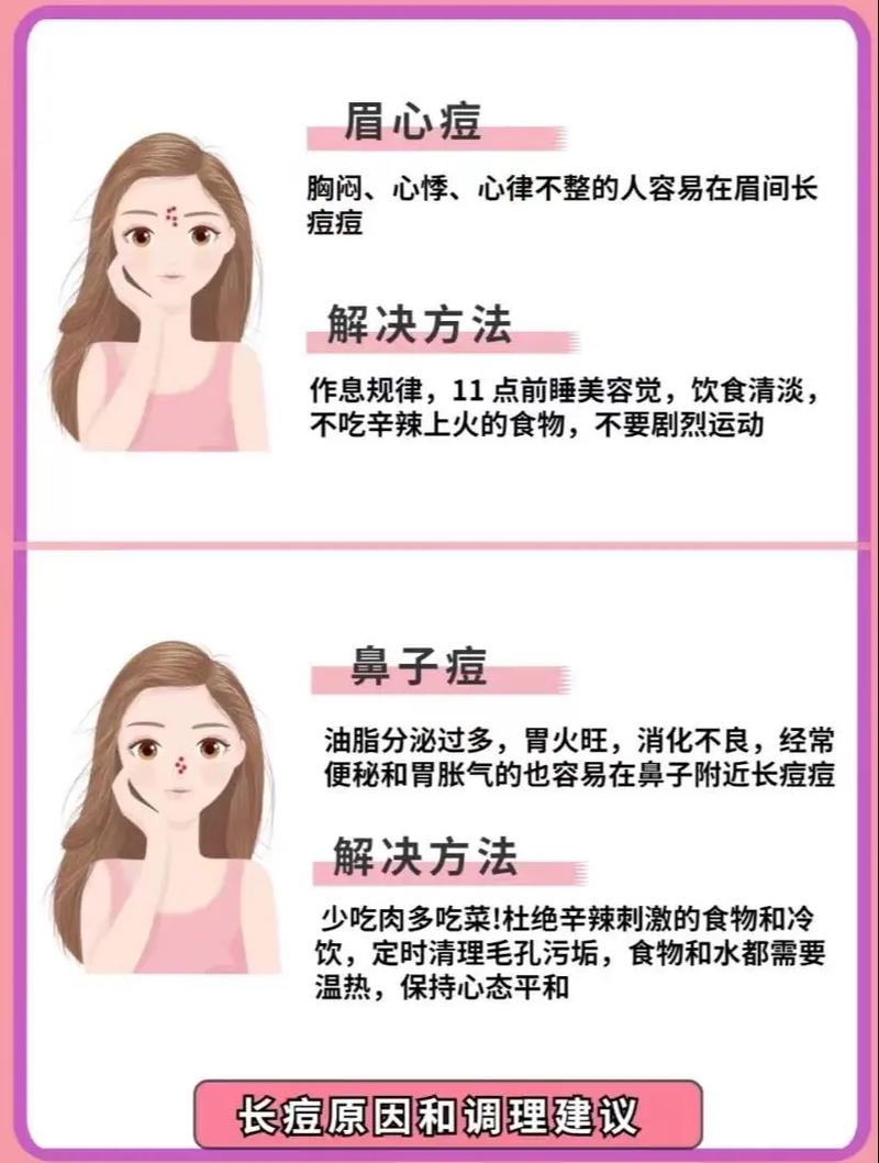 脸上为什么会起痘