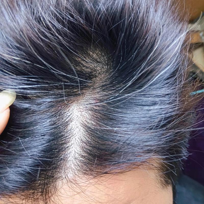 头发白看什么科