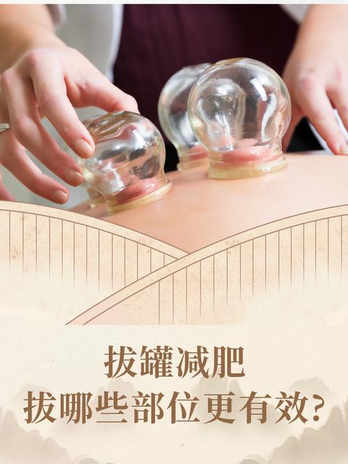 拔火罐什么部位能减肥