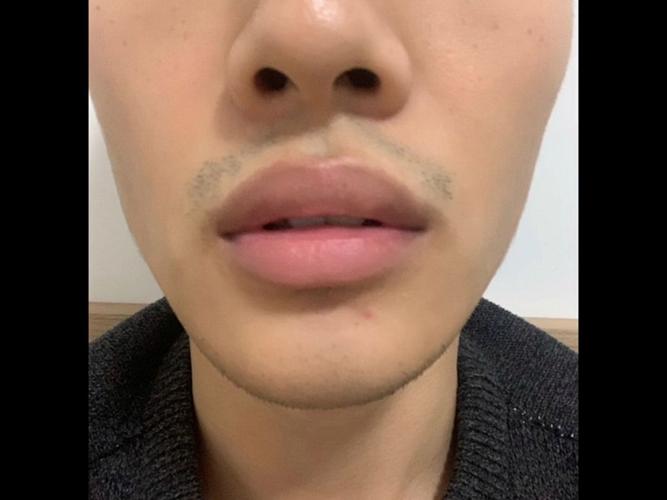 男生嘴唇厚代表什么