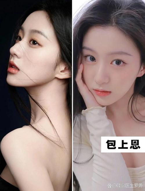 山根低代表什么