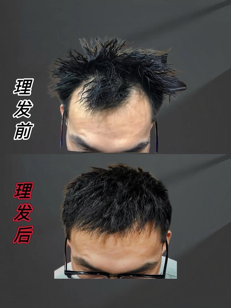 发际线低适合什么发型