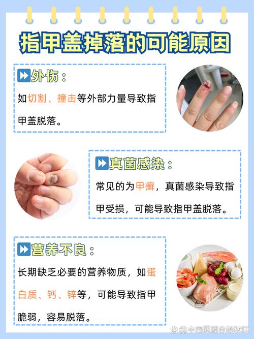 指甲脱落挂什么科