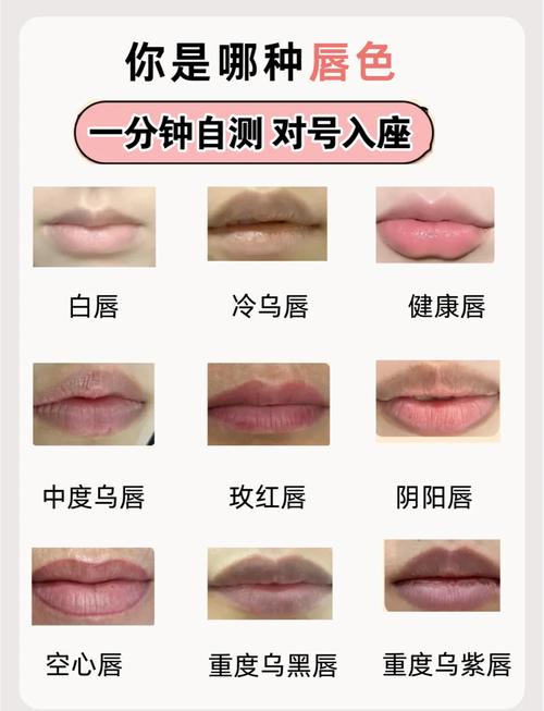 为什么嘴唇颜色深