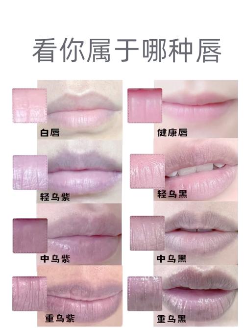 为什么嘴唇颜色深