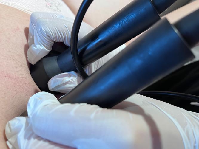 拔罐减肥可以吃什么