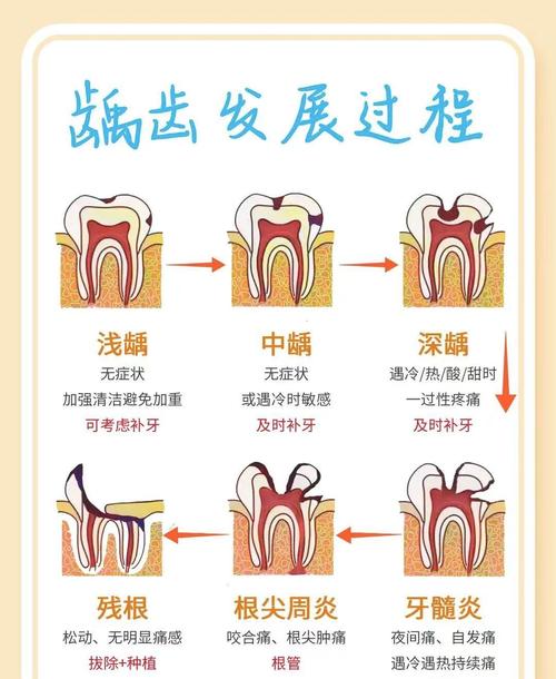 龋齿有什么危害