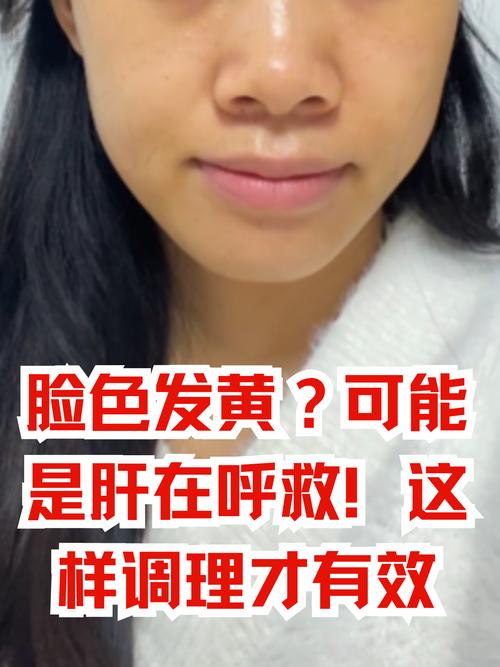 脸黄手黄是什么原因