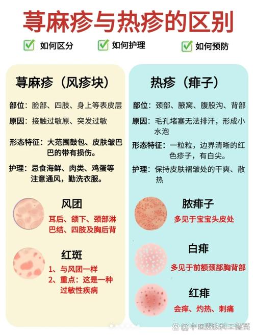 荨麻疹应注意什么
