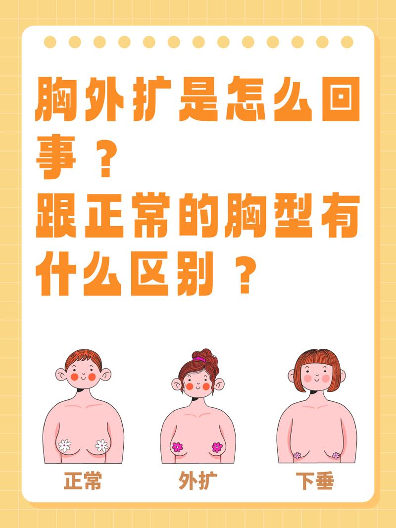 什么是胸外扩