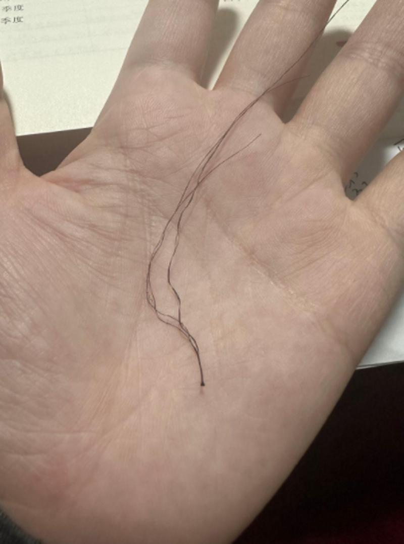 头发毛囊什么样