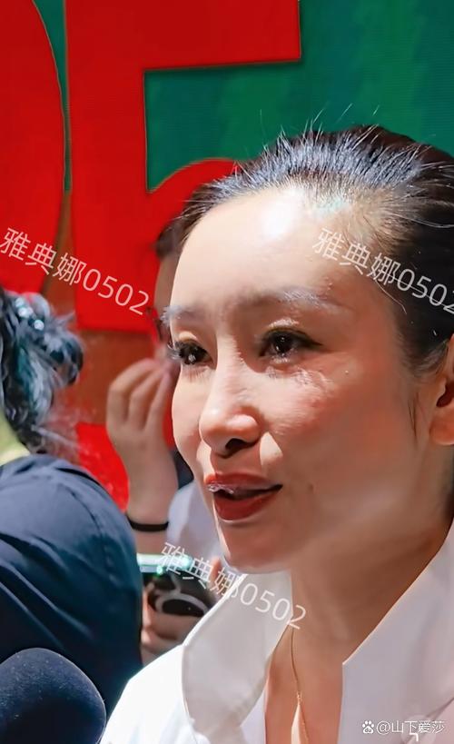 发际线为什么会高