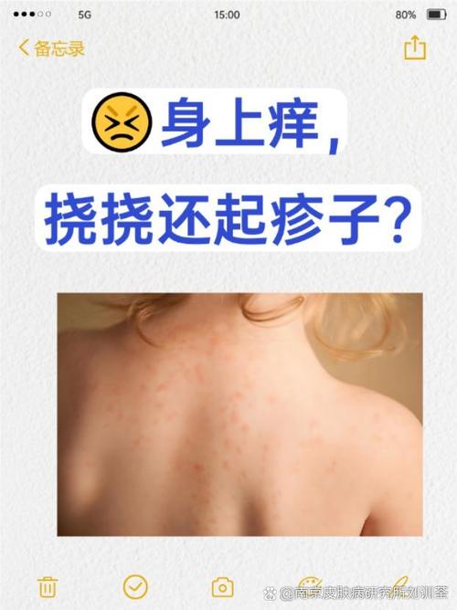 身体瘙痒是什么原因