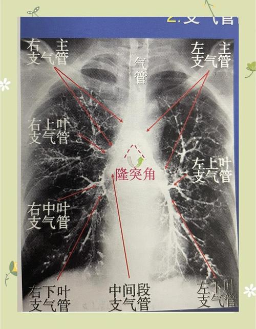 医学dr是什么意思