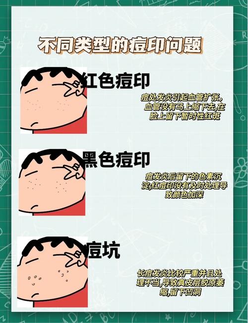 用什么方法去痘印