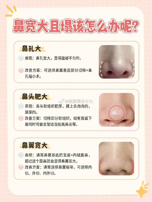 鼻梁为什么会塌