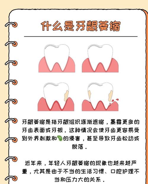 牙龈萎缩缺什么