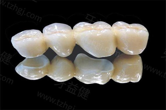 什么是陶瓷牙