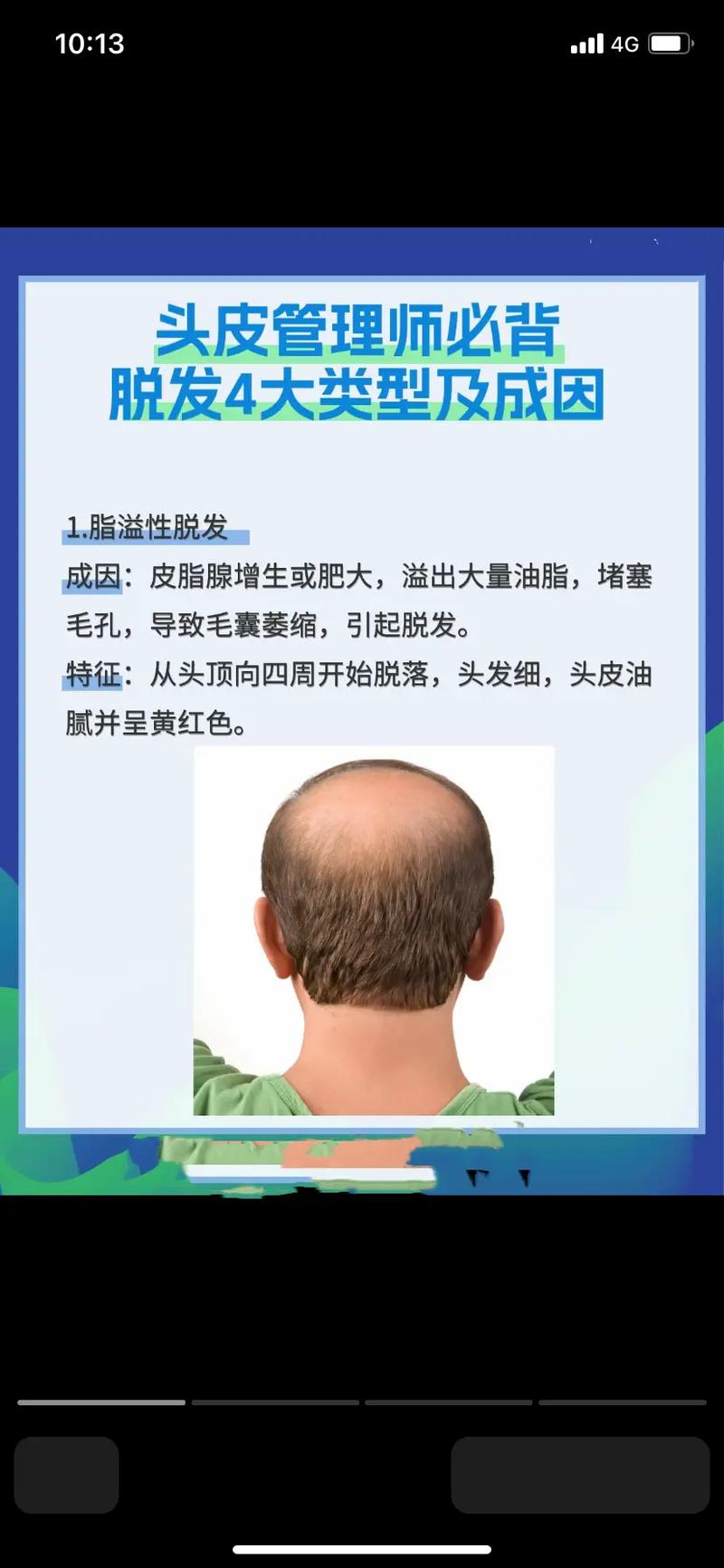 头发掉多是什么原因