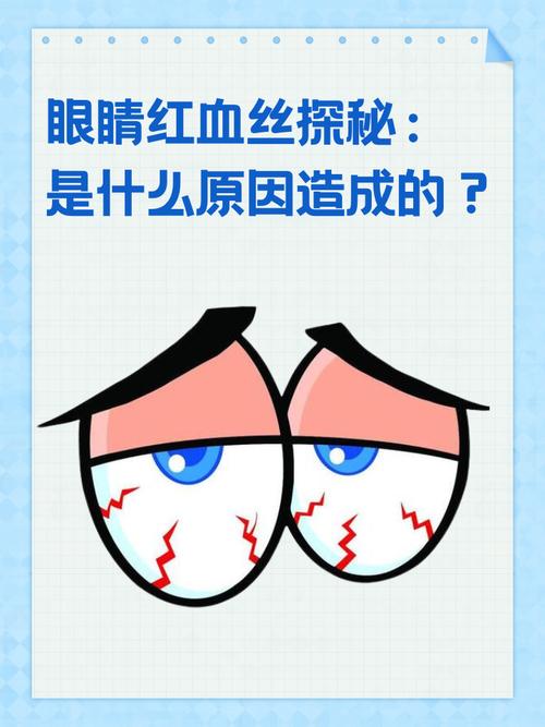 为什么眼睛里有血丝