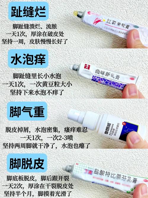 什么治脚气效果最好