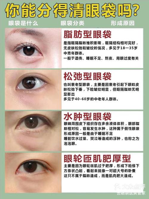 有什么办法去眼袋