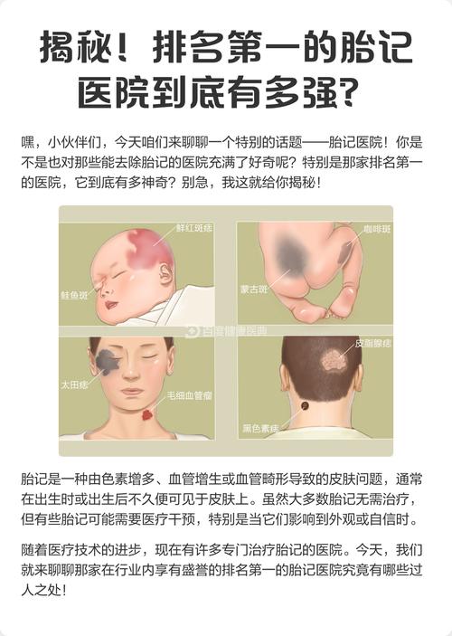 去胎记挂什么科