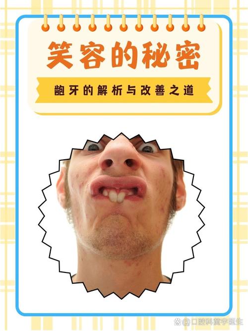 为什么会长龅牙