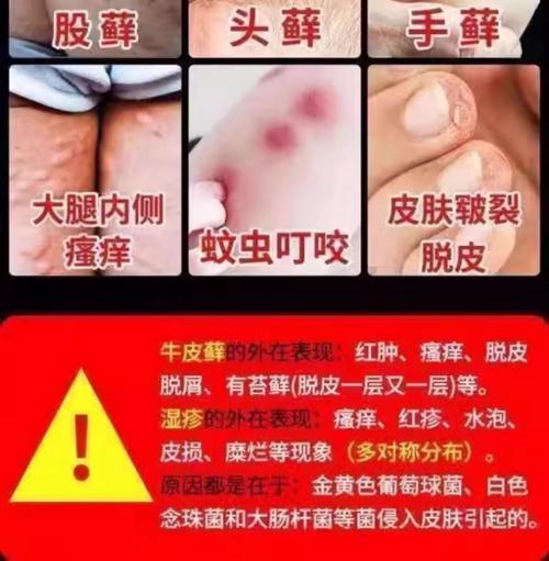 什么办法可以止痒