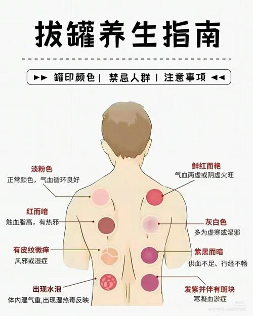 拔罐能治什么病