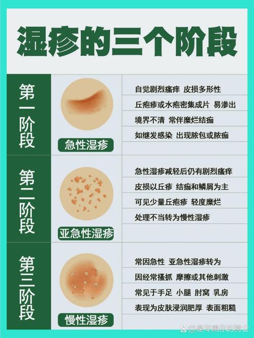 皮肤湿疹是什么原因