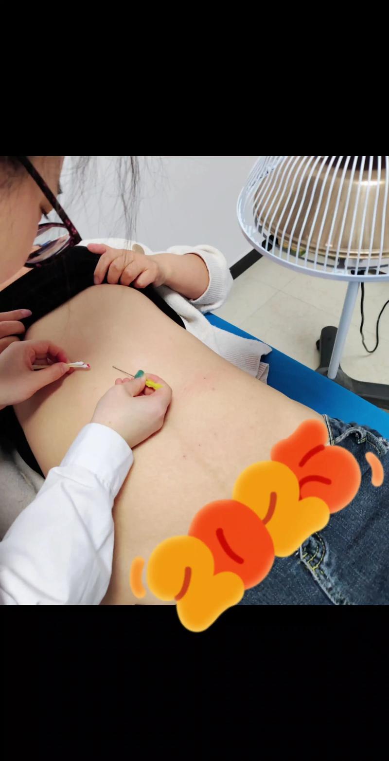 埋线减肥吃些什么