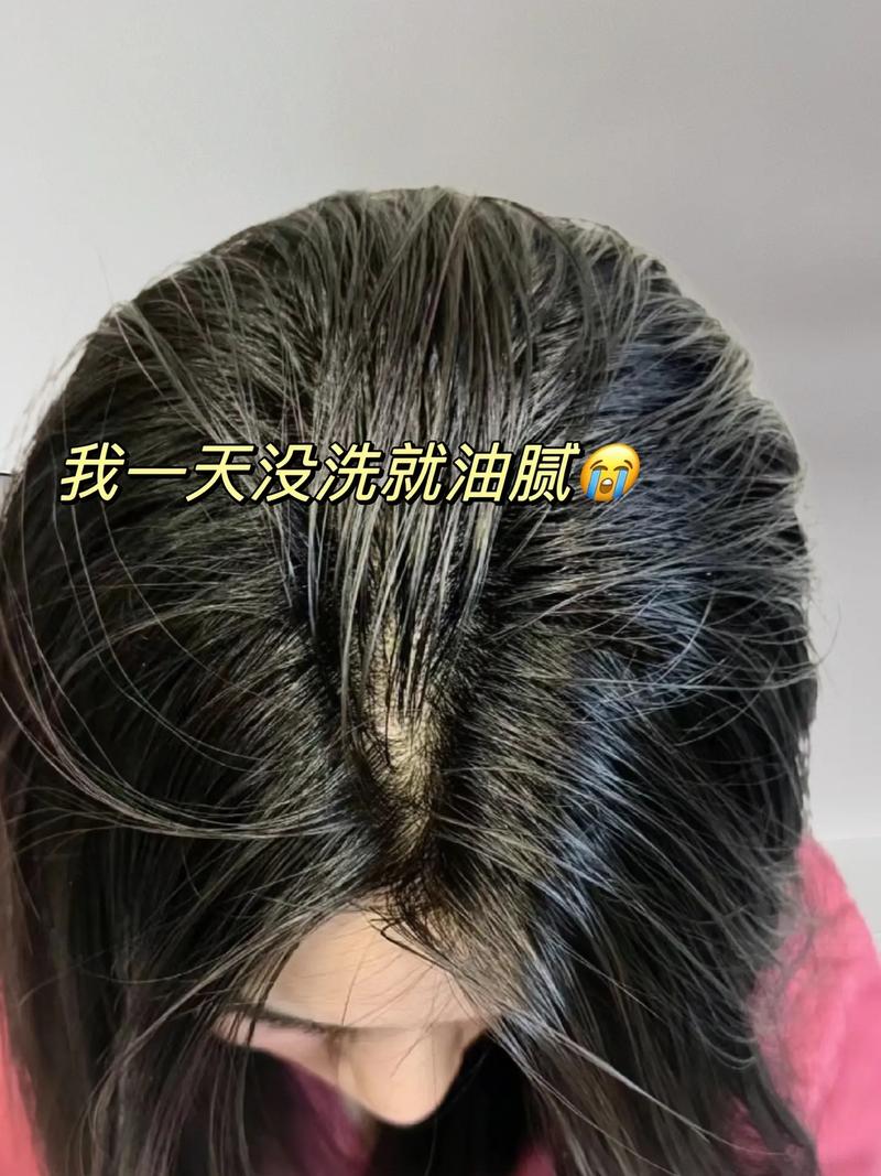 头发出油吃什么好