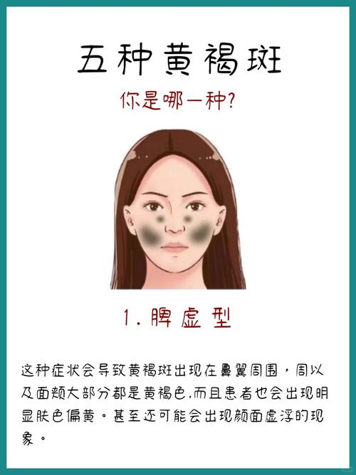 脸上长斑是为什么