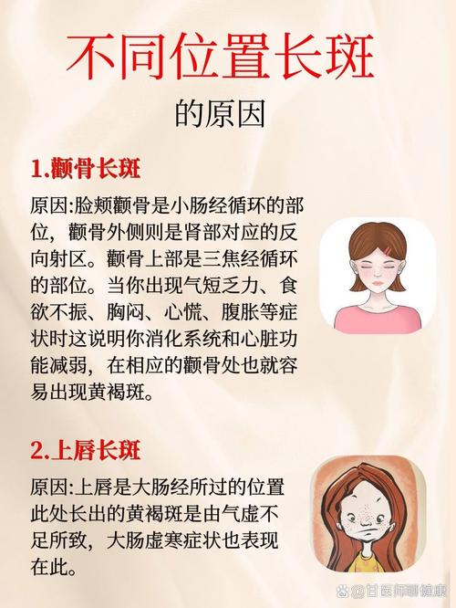 脸上长斑是为什么