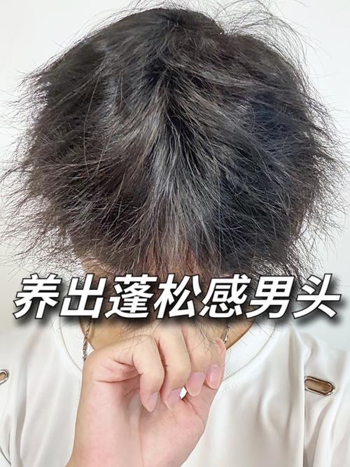 头发蓬松是什么原因