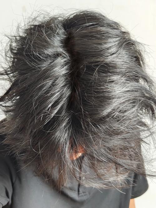 头发蓬松是什么原因