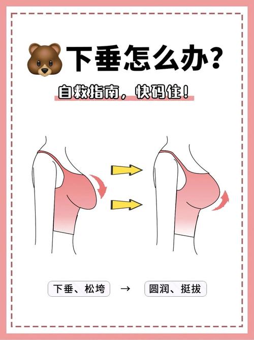 胸下垂什么意思