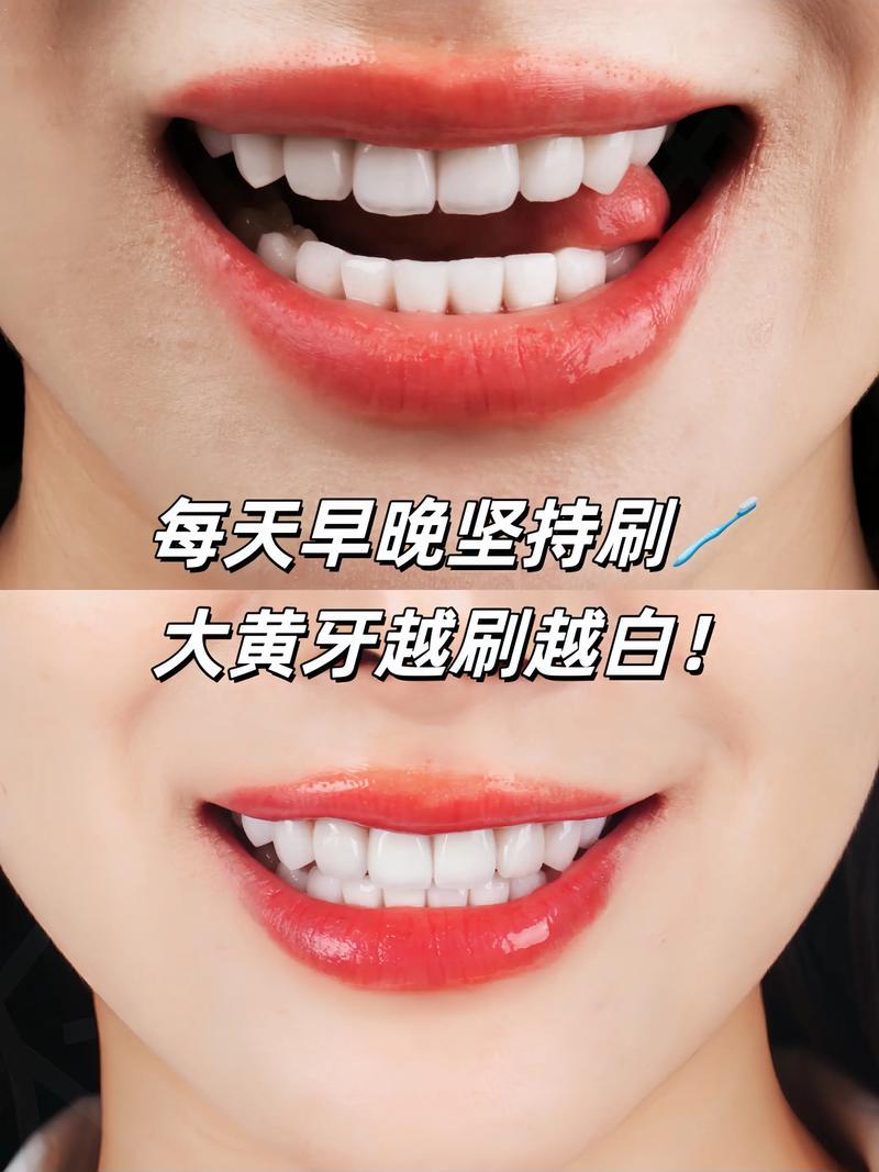 用什么可以美白牙齿