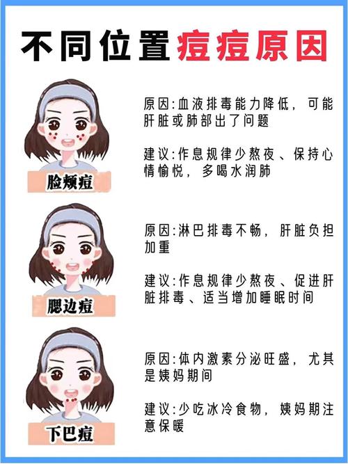 为什么会突然长痘痘