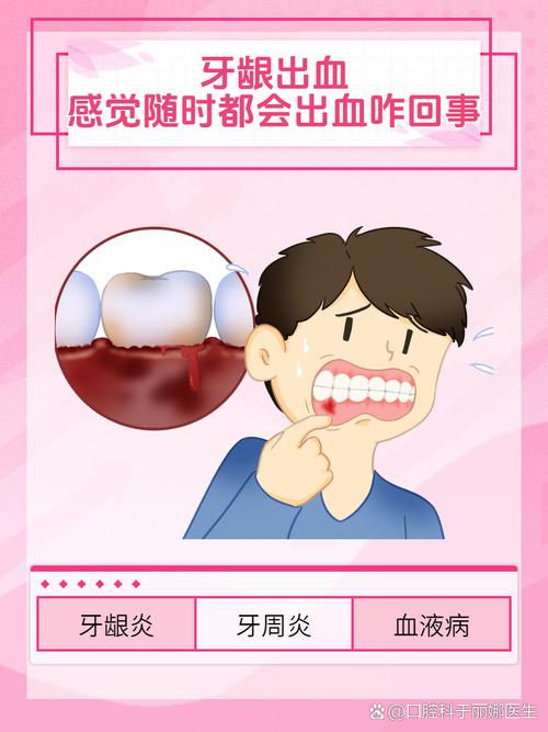 口腔出血是什么病